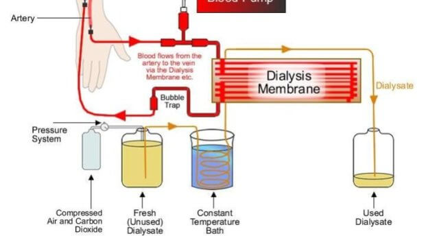 Dialysis Water Filtration Systems and Contaminants - ProEconomy