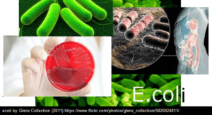 e. coli infections
