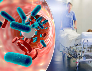 Legionnaires’ disease and Post-Traumatic Stress