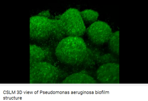 Facts About Pseudomonas Aeruginosa